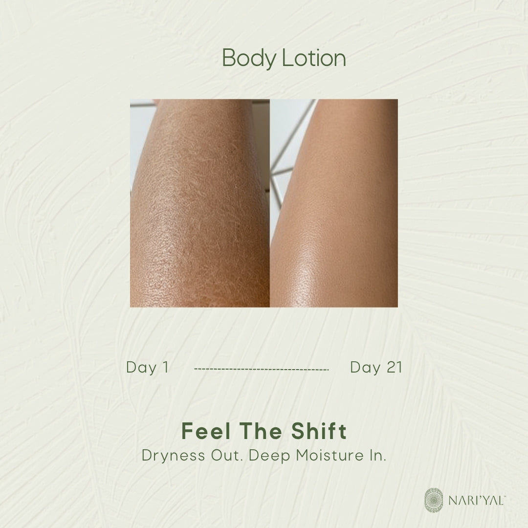 Body Lotion + 3 Soaps Combo