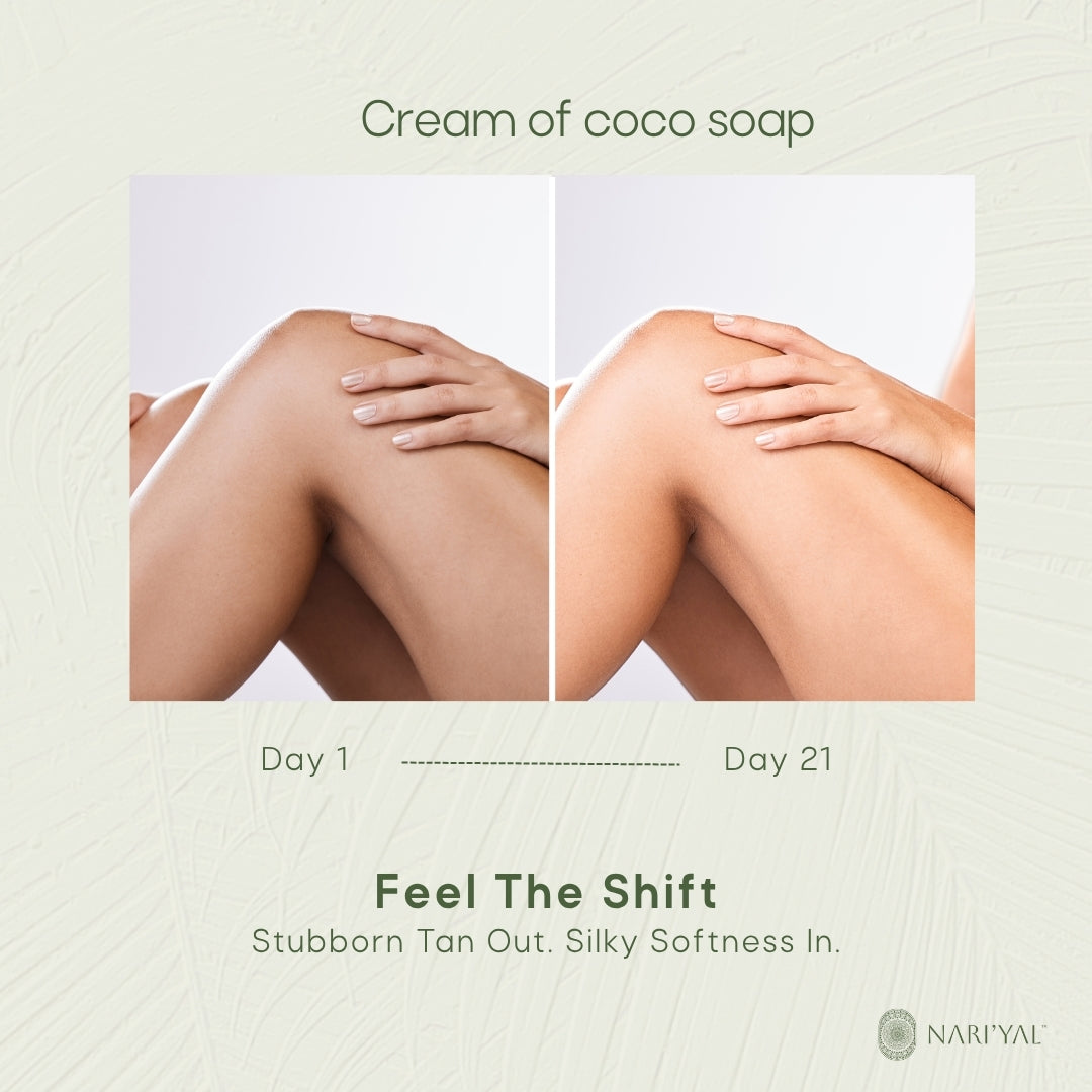 Body Lotion + 3 Soaps Combo