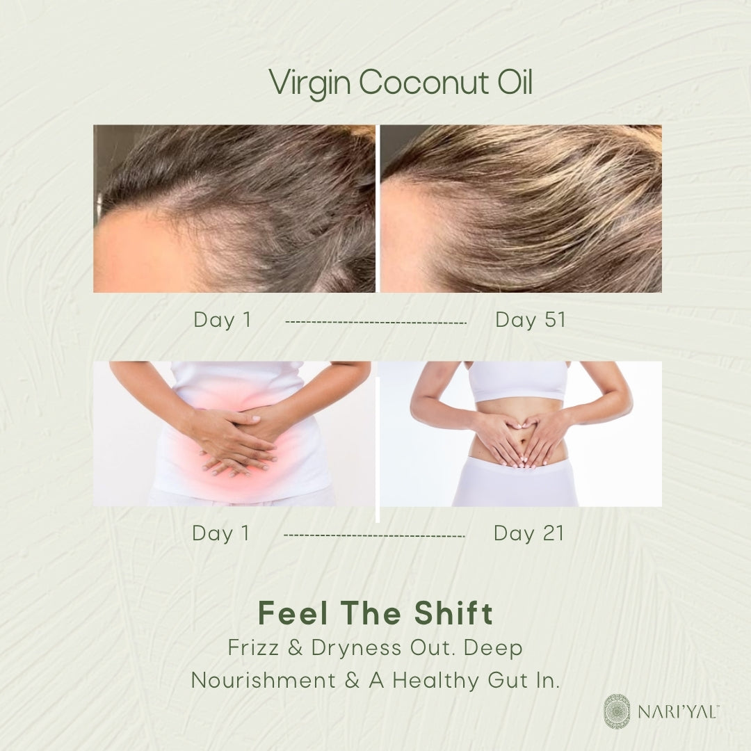 Body Lotion + Virgin Coconut Oil Cold Pressed Combo