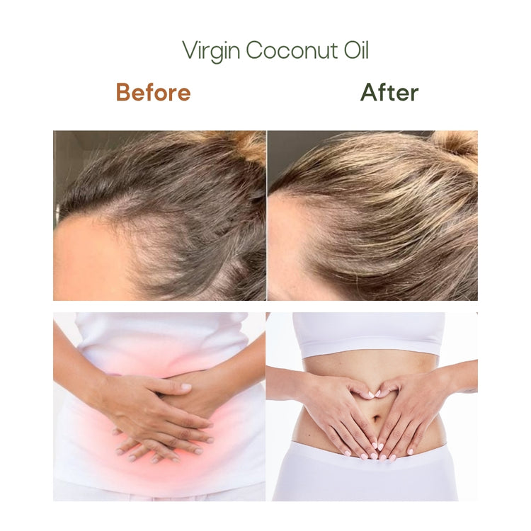 Virgin Coconut Oil Cold Pressed + Lip Balm Combo