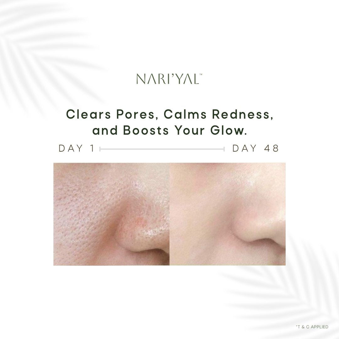 Pore Blaster Face Wash (100 ml)