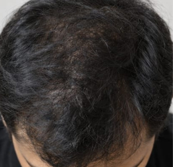 Before